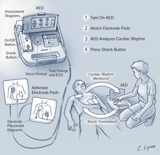 Defibrillator-components